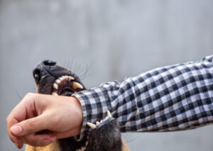 Parker Law Firm Injury Lawyers | Bedford Dog Bite Lawyer How Can Our Personal Injury Attorneys Help After a Dog Attack in Bedford, TX?