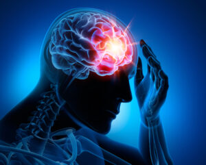 Parker Law Firm Injury Lawyers | Bedford Brain Injury Lawyer Overview of Brain Injuries
