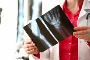 Parker Law Firm Injury Lawyers | Fort Worth Bicycle Accident Lawyer Near You Common Bicycle Accident Injuries