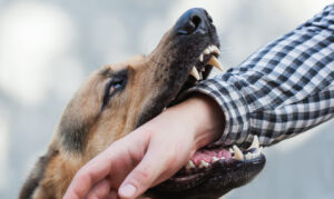 Dog Bites and Negligence Claims in Fort Worth, TX