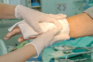 Parker Law Firm Injury Lawyers | Fort Worth Burn Injury Lawyer How Parker Law Firm Injury Lawyers Can Help if You’ve Sustained a Burn Injury in Fort Worth